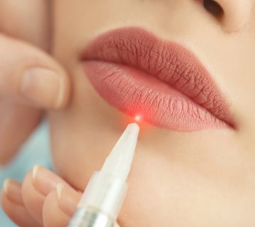 Laserowe usuwanie makijażu permanentnego: jak wygląda zabieg?
