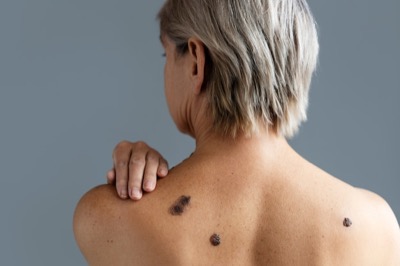 Dermatologia